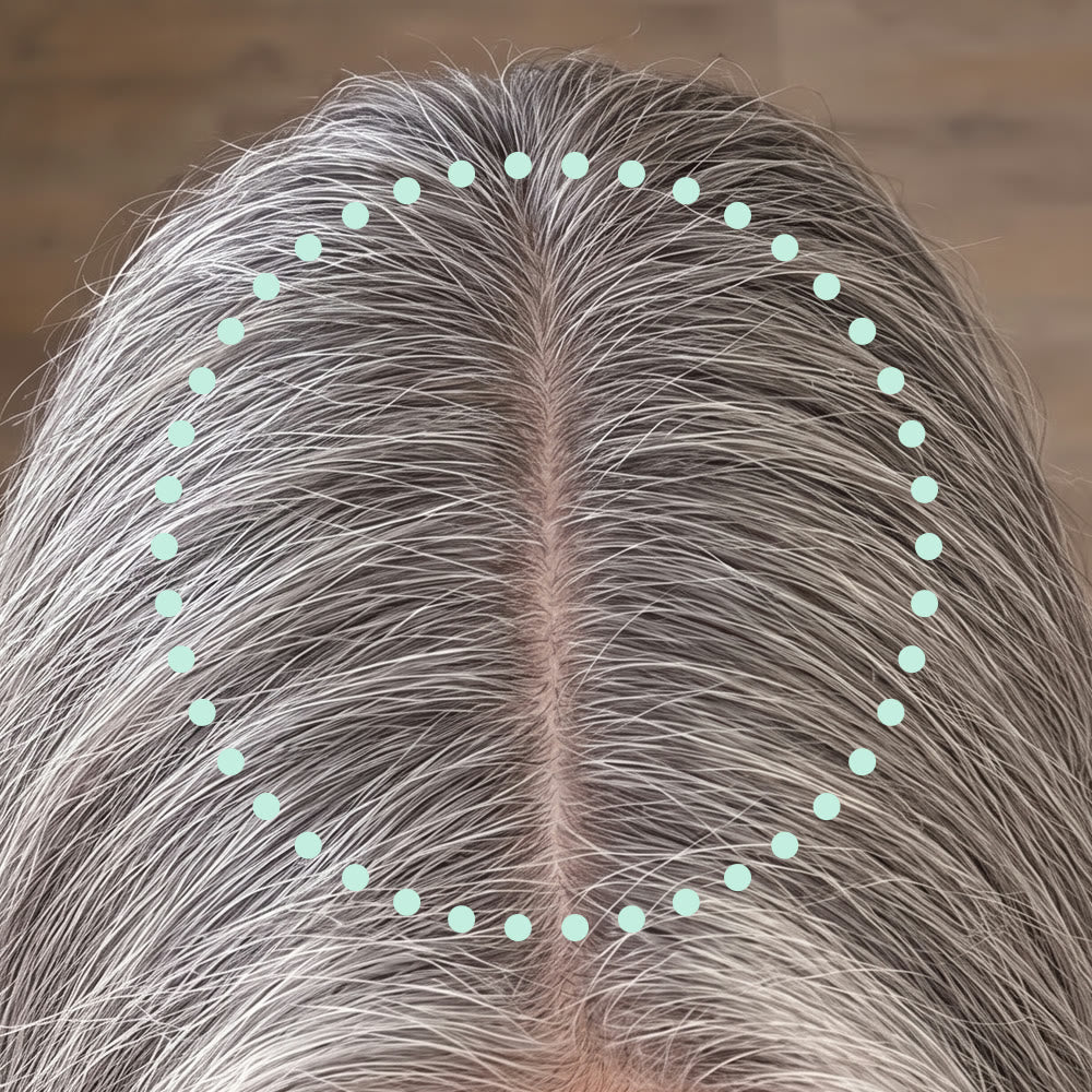 Janet’s part after 90 days of Grow Bites